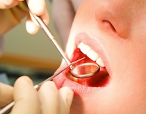 Our Professional Detist - General Dentistry, Fillings, Dentures